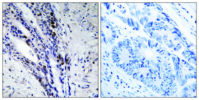 Anti-Histone H2A antibody produced in rabbit affinity isolated antibody