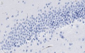 Anti-PROX1 Antibody, clone 1B10 ZooMAb® Rabbit Monoclonal recombinant, expressed in HEK 293 cells