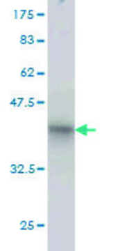 抗-RHOT1单克隆抗体 小鼠抗 clone 4H4, purified immunoglobulin, buffered aqueous solution