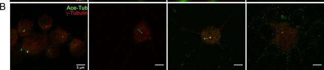 Anti-Tubulin Antibody, Detyrosinated Chemicon&#174;, from rabbit