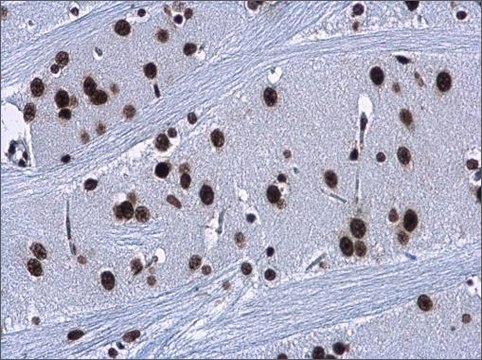 Anti-HMGA2 antibody produced in rabbit