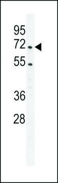 ANTI-PRMT4 (CENTER) antibody produced in rabbit affinity isolated antibody, buffered aqueous solution