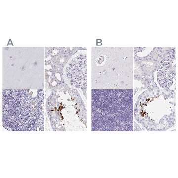 Anti-TEX44 antibody produced in rabbit Prestige Antibodies&#174; Powered by Atlas Antibodies, affinity isolated antibody, buffered aqueous glycerol solution