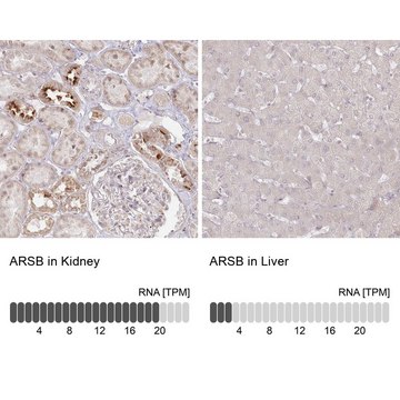 Anti-ARSB antibody produced in rabbit Prestige Antibodies&#174; Powered by Atlas Antibodies, affinity isolated antibody, buffered aqueous glycerol solution