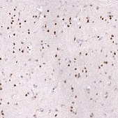 Monoclonal Anti-Zeb2 Antibody Produced In Mouse Prestige Antibodies® Powered by Atlas Antibodies, clone CL13467, affinity isolated antibody, buffered aqueous glycerol solution
