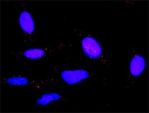 Anti-IL6 antibody produced in rabbit purified immunoglobulin, buffered aqueous solution