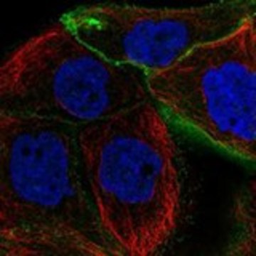 Anti-PDPN antibody produced in rabbit Prestige Antibodies&#174; Powered by Atlas Antibodies, affinity isolated antibody, buffered aqueous glycerol solution