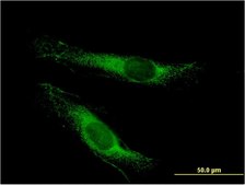 Monoclonal Anti-LSS, (C-terminal) antibody produced in mouse clone 2E4, purified immunoglobulin, buffered aqueous solution