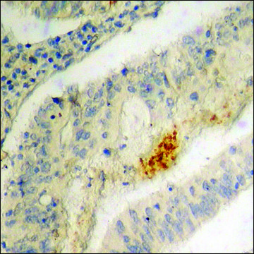 Anti-phospho-IRF-3 (pSer396) antibody produced in rabbit affinity isolated antibody