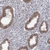 Anti-TRUB1 antibody produced in rabbit Prestige Antibodies® Powered by Atlas Antibodies, affinity isolated antibody, buffered aqueous glycerol solution
