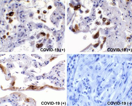 Anti-SARS-CoV-2 (COVID-19) Spike antibody produced in rabbit affinity isolated antibody