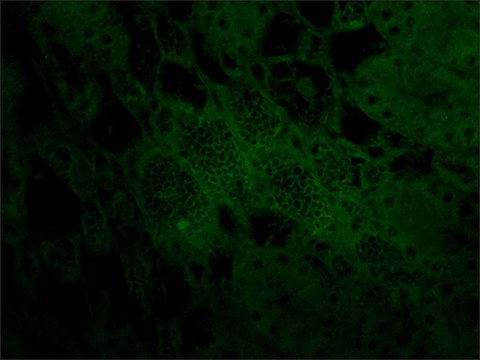 抗-平足蛋白 (HG-19) 兔抗 affinity isolated antibody, buffered aqueous solution