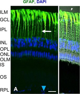 Anti-Glial Fibrillary Acidic Protein antibody, Mouse monoclonal clone G-A-5, purified from hybridoma cell culture