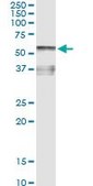 Monoclonal Anti-AHSG, (C-terminal) antibody produced in mouse clone 1D8, purified immunoglobulin, buffered aqueous solution
