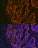 Anti-CEACAM6 Antibody, clone 4Z3V7, Rabbit Monoclonal