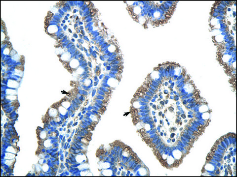 Anti-FUS affinity isolated antibody