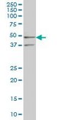 Monoclonal Anti-SEPHS2 antibody produced in mouse clone 2G9, purified immunoglobulin, buffered aqueous solution