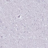 Anti-CD177 antibody produced in rabbit Prestige Antibodies® Powered by Atlas Antibodies, affinity isolated antibody