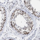 Anti-TPR antibody produced in rabbit Prestige Antibodies® Powered by Atlas Antibodies, affinity isolated antibody, buffered aqueous glycerol solution, Ab2