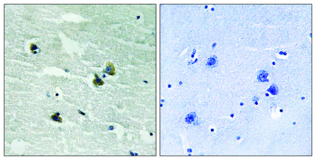 Anti-phospho-MER/SKY (pTyr749/681) antibody produced in rabbit affinity isolated antibody