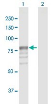 Anti-GUSB antibody produced in rabbit purified immunoglobulin, buffered aqueous solution