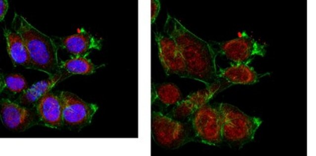 Anti-Peroxiredoxin 1 from rabbit, purified by affinity chromatography