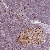 Anti-DUT antibody produced in rabbit Prestige Antibodies® Powered by Atlas Antibodies, affinity isolated antibody, buffered aqueous glycerol solution