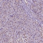 Anti-CTR9 antibody produced in rabbit Prestige Antibodies® Powered by Atlas Antibodies, affinity isolated antibody, buffered aqueous glycerol solution