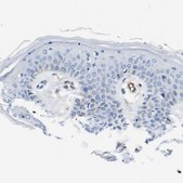 Anti-DYSF antibody produced in rabbit Prestige Antibodies® Powered by Atlas Antibodies, affinity isolated antibody, buffered aqueous glycerol solution