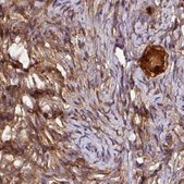 Anti-ST13 antibody produced in rabbit Prestige Antibodies® Powered by Atlas Antibodies, affinity isolated antibody, buffered aqueous glycerol solution