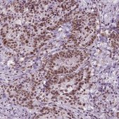Monoclonal Anti-BRD4 antibody produced in mouse Prestige Antibodies® Powered by Atlas Antibodies, clone CL1115, purified immunoglobulin, buffered aqueous glycerol solution