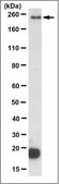 Anti-Dysferlin/DYSF Antibody, clone 10H3.1 clone 10H3.1, from mouse