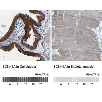 Anti-SCNN1A antibody produced in rabbit Prestige Antibodies&#174; Powered by Atlas Antibodies, affinity isolated antibody, buffered aqueous glycerol solution