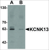 Anti-KCNK13 antibody produced in rabbit affinity isolated antibody