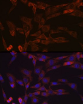 Anti-Inhibin beta A (INHBA) Antibody, clone 1X6N9, Rabbit Monoclonal