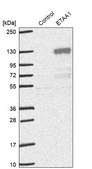 Anti-ETAA1 antibody produced in rabbit Prestige Antibodies® Powered by Atlas Antibodies, affinity isolated antibody, buffered aqueous glycerol solution