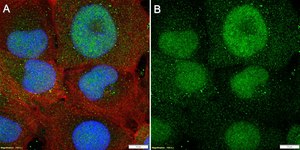 Anti-GLI-2 Antibody, clone 1G4 ZooMAb® Rabbit Monoclonal recombinant, expressed in HEK 293 cells