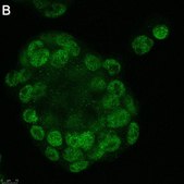 Anti-GLS2 Antibody, clone 3G12 ZooMAb® Rabbit Monoclonal recombinant, expressed in HEK 293 cells