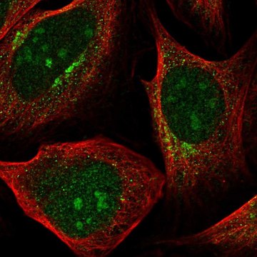 Anti-PDK1 antibody produced in rabbit Prestige Antibodies&#174; Powered by Atlas Antibodies, affinity isolated antibody