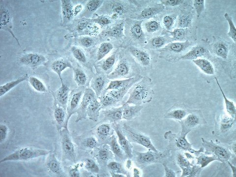 TPC-1 Human Papillary Thyroid Carcinoma Cell line TPC-1 human papillary thyroid carcinoma cell line is a highly characterized model for thyroid cancer research.