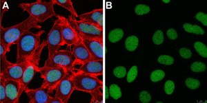 Anti-ZEB1 Antibody, clone 5C20 ZooMAb® Rabbit Monoclonal recombinant, expressed in HEK 293 cells
