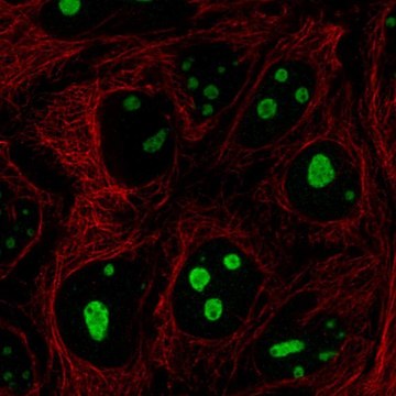 Anti-SREK1IP1 antibody produced in rabbit Prestige Antibodies&#174; Powered by Atlas Antibodies, affinity isolated antibody