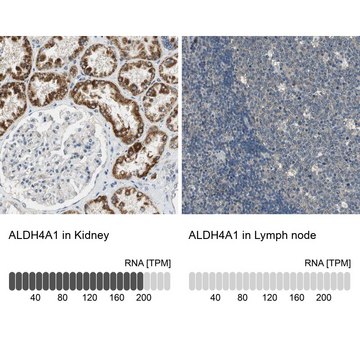 Anti-ALDH4A1 antibody produced in rabbit Prestige Antibodies&#174; Powered by Atlas Antibodies, affinity isolated antibody, buffered aqueous glycerol solution