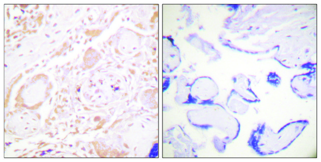 Anti-GATA3 antibody produced in rabbit affinity isolated antibody