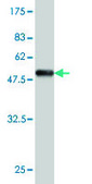 Monoclonal Anti-VSNL1 antibody produced in mouse clone 2F1-E3, purified immunoglobulin, buffered aqueous solution