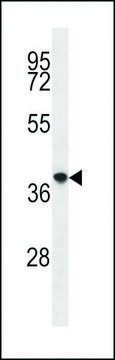 ANTI-PQLC2(C-TERMINAL) antibody produced in rabbit affinity isolated antibody, buffered aqueous solution