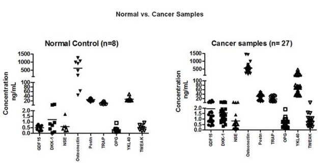 MILLIPLEX&#174; Human Cancer/ Metastasis Biomarker Magnetic Bead Panel - Cancer Multiplex Assay Circulating Cancer and Metastasis Biomarker Bead-Based Multiplex Assays using the Luminex technology enables the simultaneous analysis of multiple oncology biomarkers in various tumor types in human serum, plasma and cell culture samples.