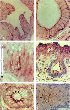 Monoclonal Anti-Phosphotyrosine antibody produced in mouse