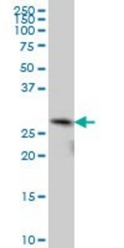 ANTI-TGIF2 antibody produced in mouse clone 5G1, purified immunoglobulin, buffered aqueous solution