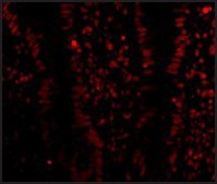 Anti-LSD1 antibody produced in rabbit affinity isolated antibody